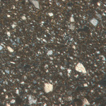 Plate 7.1: Photomicrograph of GAB TR 1A (XPL) (width of field 1.74 mm). Click to see a larger version