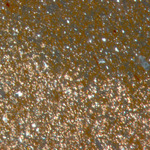 Plate 18.1: Photomicrograph of MON SA (XPL) (width of field 1.74 mm). Click to see a larger version