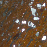 Plate 135.1: Photomicrograph of SWN WS (XPL) (width of field 1.74 mm). Click to see a larger version