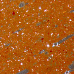 Plate 17.1: Photomicrograph of LGF SA (XPL) (width of field 1.74 mm). Click to see a larger version