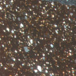 Plate 45.1: Photomicrograph of NOI EG (XPL) (width of field 1.74 mm). Click to see a larger version